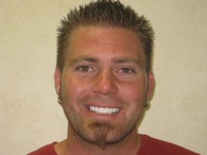 crown dentist after photo